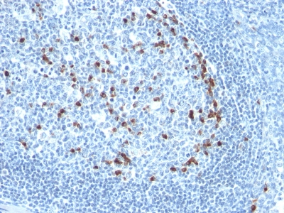 Formalin-fixed, paraffin embedded human tonsil sections stained with 100 ul anti-Kappa Light Chain (clone KLC709) at 1:50. HIER epitope retrieval prior to staining was performed in 10mM Citrate, pH 6.0.